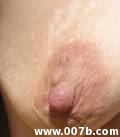 nipple picture where you can see stretch marks on the breast too