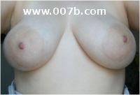 36D breasts