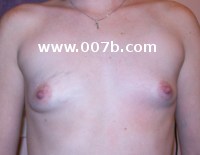 small breasts