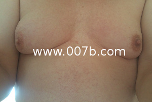 36a Natural Boobs - Normal Breasts Photos, part 5 - pictures of different size ...