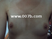 breasts