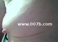a breast