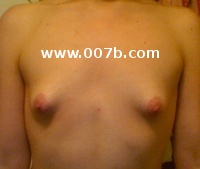 small breasts