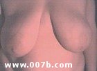 large pendulous breasts