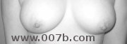 breasts