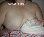 drooping breasts