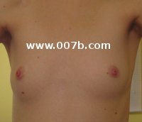 small AA breasts