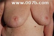 breasts