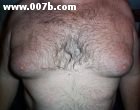 breasts of overweight man