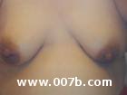 breasts of a pregnant woman