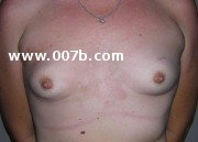 small breasts of a 20-year old