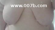 breasts of an obese woman