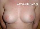young woman's breasts